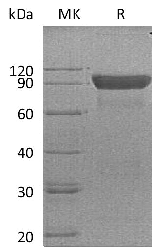 BL-0169NP: Greater than 95% as determined by reducing SDS-PAGE. (QC verified)Recombinant Human SIRPA Protein (C-Fc)