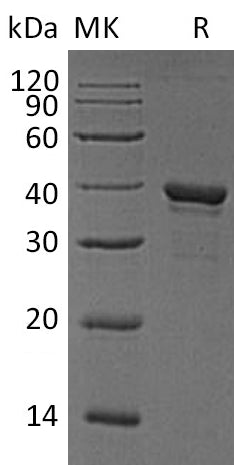 BL-0290NP: Greater than 90% as determined by reducing SDS-PAGE. (QC verified)Recombinant Human ARG1 Protein (C-6His)