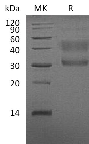 BL-1085NP: Greater than 95% as determined by reducing SDS-PAGE. (QC verified)Recombinant Human HGF R Protein (Truncated,C-6His)