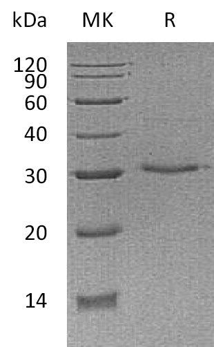 BL-1089NP: Greater than 95% as determined by reducing SDS-PAGE. (QC verified)Recombinant Human VSIG8 Protein (C-6His)