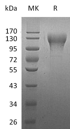 BL-1086NP: Greater than 90% as determined by reducing SDS-PAGE. (QC verified)Recombinant Human CD96 Protein (C-6His)