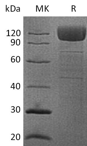 BL-0171NP: Greater than 90% as determined by reducing SDS-PAGE. (QC verified)Recombinant Human CD36 Protein (C-Fc)