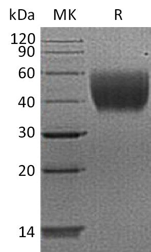 BL-2101NP: Greater than 95% as determined by reducing SDS-PAGE. (QC verified)Recombinant Human IL-10RA Protein (C-6His)