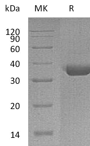 BL-1091NP: Greater than 95% as determined by reducing SDS-PAGE. (QC verified)Recombinant Human TPSAB1 Protein (C-6His)