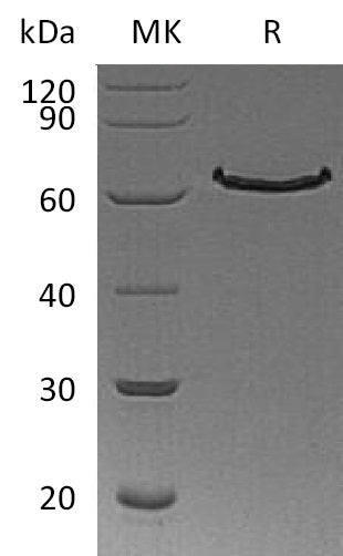 BL-1094NP: Greater than 95% as determined by reducing SDS-PAGE. (QC verified)Recombinant Human DLL1 Protein (C-6His)