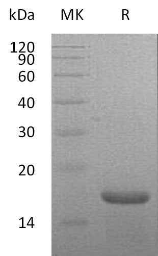 BL-1098NP: Greater than 95% as determined by reducing SDS-PAGE. (QC verified)Recombinant Mouse IL-21 Protein (N-6His)