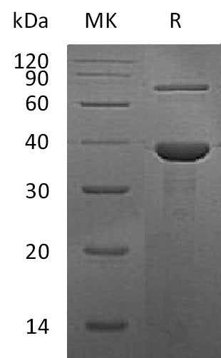 BL-1100NP: Greater than 95% as determined by reducing SDS-PAGE. (QC verified)