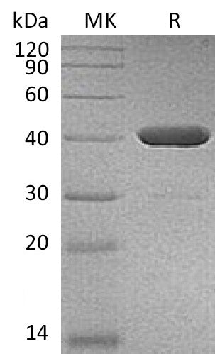 BL-1640NP: Greater than 95% as determined by reducing SDS-PAGE. (QC verified)Recombinant Human IDO2 Protein (C-6His)