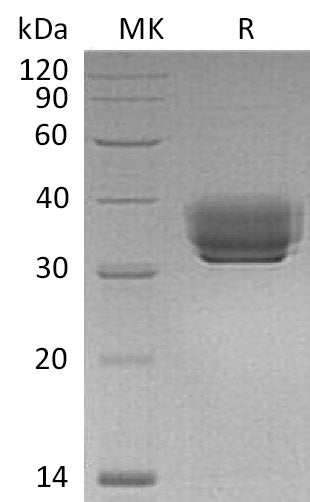 BL-1112NP: Greater than 95% as determined by reducing SDS-PAGE. (QC verified)Recombinant Mouse BTN1A1 Protein (C-6His)