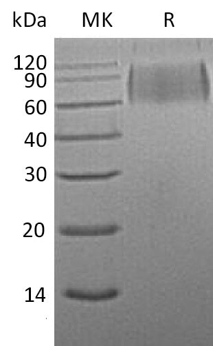 BL-1114NP: Greater than 95% as determined by reducing SDS-PAGE. (QC verified)Recombinant Mouse SIRPA Protein (C-6His)