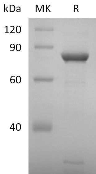 BL-2678NP: Greater than 95% as determined by reducing SDS-PAGE. (QC verified)Recombinant 2019-nCoV NSP2 Protein (C-6His)