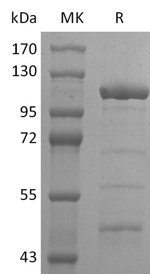 BL-2533NP: Greater than 80% as determined by reducing SDS-PAGE. (QC verified)Recombinant 2019-nCoV Helicase Protein (N-6His-MBP)