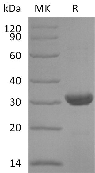 BL-2912NP: Greater than 95% as determined by reducing SDS-PAGE. (QC verified)Recombinant Human NNT Protein (N-6His)