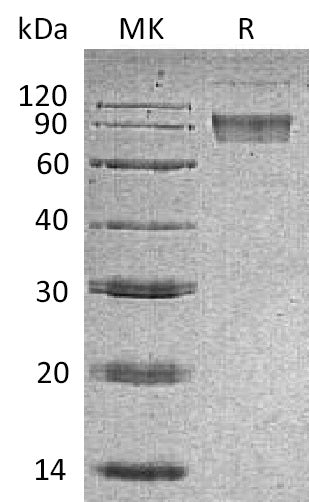 BL-0172NP: Greater than 95% as determined by reducing SDS-PAGE. (QC verified)