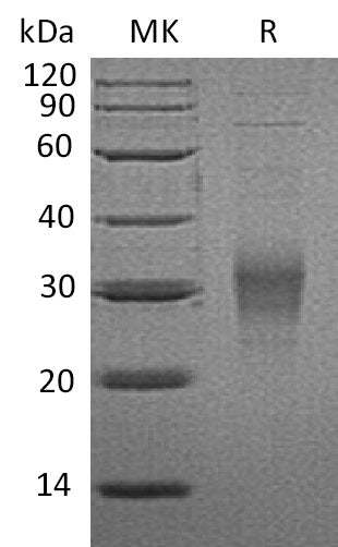 BL-1116NP: Greater than 95% as determined by reducing SDS-PAGE. (QC verified)Recombinant Mouse FcgR4 Protein (C-6His)