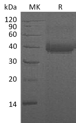 BL-1978NP: Greater than 95% as determined by reducing SDS-PAGE. (QC verified)Recombinant Human CD23 Protein (N-8His)