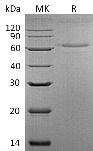 BL-1127NP: Greater than 90% as determined by reducing SDS-PAGE. (QC verified)Recombinant Mouse IL-27 Protein (C-6His)