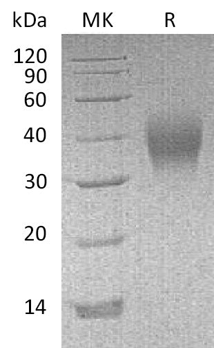 BL-1121NP: Greater than 95% as determined by reducing SDS-PAGE. (QC verified)Recombinant Mouse CD16Protein (C-6His)
