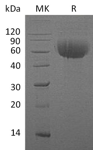 BL-0305NP: Greater than 95% as determined by reducing SDS-PAGE. (QC verified)Recombinant Human IL-13RA1 Protein (C-6His)