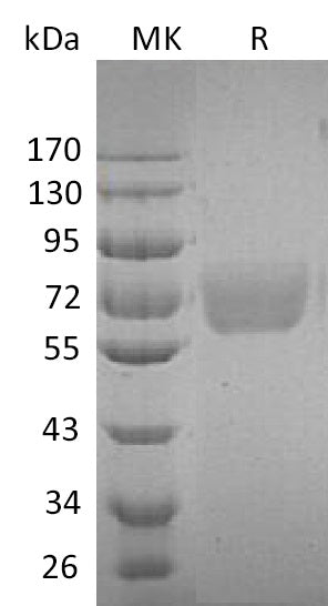 BL-0005NP: Greater than 95% as determined by reducing SDS-PAGE. (QC verified)Recombinant Human IL-4 RA Protein (C-Fc)