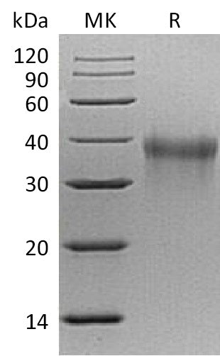 BL-1141NP: Greater than 95% as determined by reducing SDS-PAGE. (QC verified)Recombinant Mouse TREM-1 Protein (C-6His)