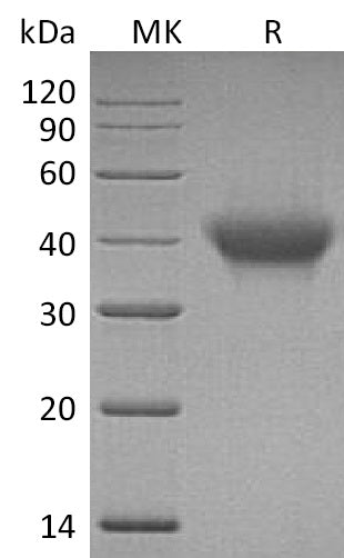 BL-1143NP: Greater than 95% as determined by reducing SDS-PAGE. (QC verified)Recombinant Human IL-5RA Protein (C-6His)