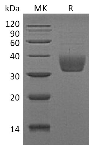 BL-1139NP: Greater than 90% as determined by reducing SDS-PAGE. (QC verified)Recombinant Mouse SLAMF8 Protein (C-6His)
