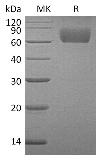 BL-1142NP: Greater than 95% as determined by reducing SDS-PAGE. (QC verified)Recombinant Human FGF R3 Protein (C-6His)