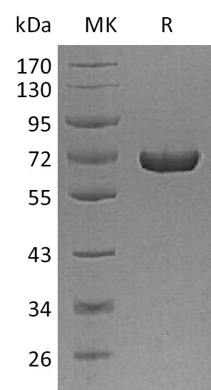 BL-1144NP: Greater than 95% as determined by reducing SDS-PAGE. (QC verified)Recombinant Human AFP Protein (C-6His)