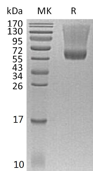 BL-1149NP: Greater than 95% as determined by reducing SDS-PAGE. (QC verified)Recombinant Human Decorin Protein (C-6His)