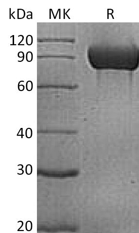 BL-1145NP: Greater than 95% as determined by reducing SDS-PAGE. (QC verified)Recombinant Human PECAM-1 Protein (C-6His)