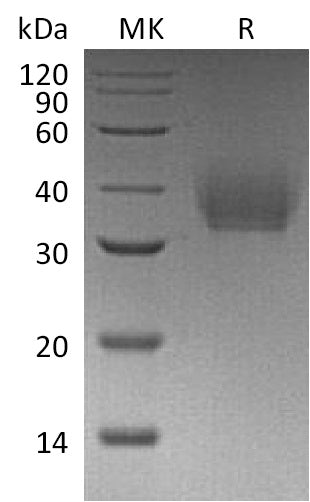 BL-1152NP: Greater than 95% as determined by reducing SDS-PAGE. (QC verified)Recombinant Mouse IL-21R Protein (C-6His)