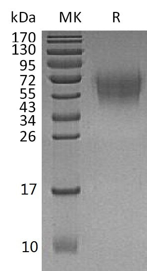 BL-1151NP: Greater than 95% as determined by reducing SDS-PAGE. (QC verified)Recombinant Human DNAM-1 Protein (C-6His)
