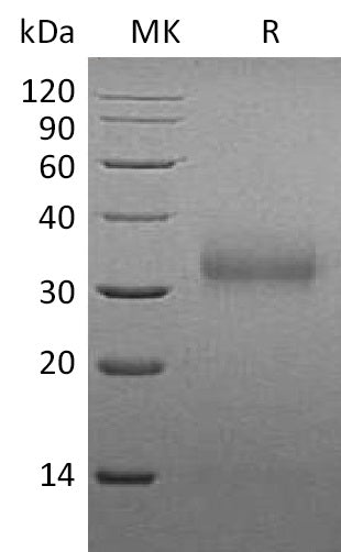 BL-1146NP: Greater than 95% as determined by reducing SDS-PAGE. (QC verified)Recombinant Mouse SOST Protein (C-6His)
