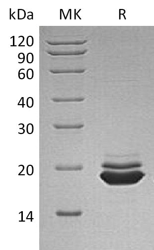 BL-1147NP: Greater than 95% as determined by reducing SDS-PAGE. (QC verified)Recombinant Human APLP-1 Protein (C-6His)