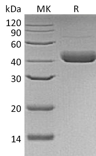 BL-1150NP: Greater than 95% as determined by reducing SDS-PAGE. (QC verified)Recombinant Human Decorin Protein (C-6His,Baculovirus)