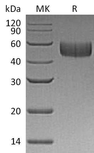 BL-1153NP: Greater than 95% as determined by reducing SDS-PAGE. (QC verified)Recombinant Human SIRPB1Protein (C-6His)