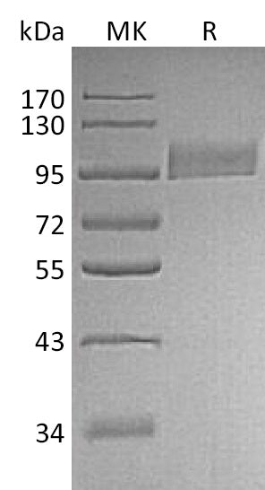 BL-2087NP: Greater than 95% as determined by reducing SDS-PAGE. (QC verified)Recombinant Human Neprilysin Protein (N-8His)