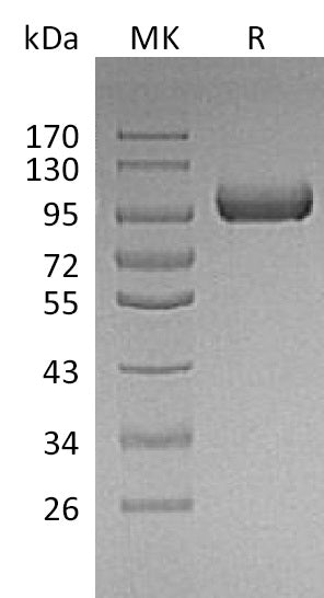BL-1154NP: Greater than 95% as determined by reducing SDS-PAGE. (QC verified)Recombinant Mouse LRIG1 Protein (C-6His)