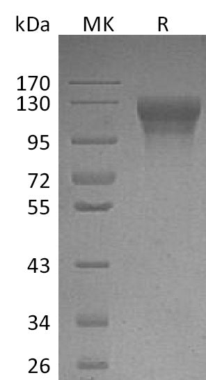 BL-1992NP: Greater than 95% as determined by reducing SDS-PAGE. (QC verified)Recombinant Human LEPR Protein (C-10His)