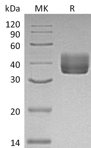 BL-1161NP: Greater than 95% as determined by reducing SDS-PAGE. (QC verified)Recombinant Mouse CD157 Protein (C-6His)
