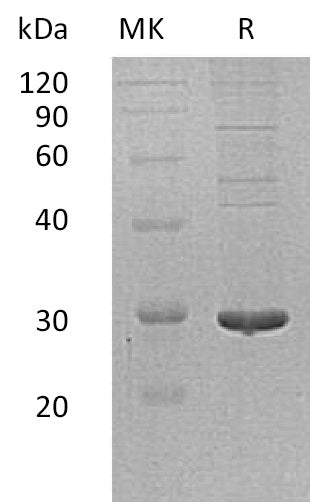 BL-1458NP: Greater than 90% as determined by reducing SDS-PAGE. (QC verified)Recombinant Human PDIA5 Protein (C-6His)