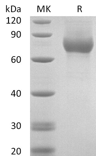 BL-2821NP: Greater than 95% as determined by reducing SDS-PAGE. (QC verified)