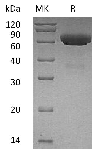 BL-0798NP: Greater than 95% as determined by reducing SDS-PAGE. (QC verified)Recombinant Human tPA Protein (C-6His)