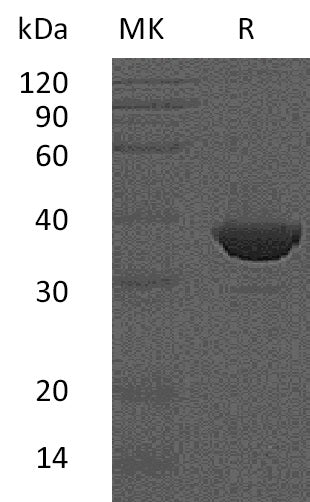 BL-1457NP: Greater than 95% as determined by reducing SDS-PAGE. (QC verified)Recombinant Human FBPase1 Protein (C-6His)
