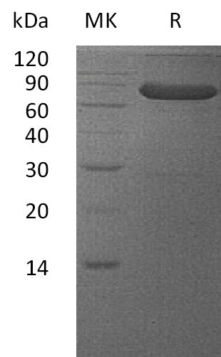 BL-0070NP: Greater than 95% as determined by reducing SDS-PAGE. (QC verified)