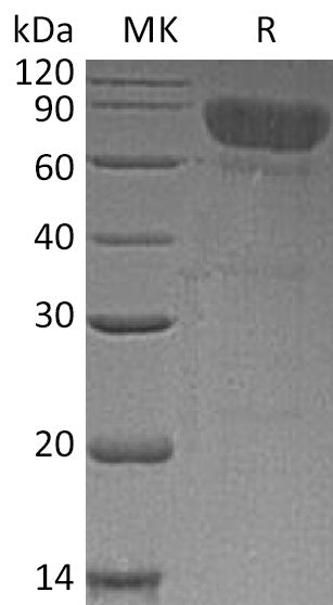 BL-0066NP: Greater than 85% as determined by reducing SDS-PAGE. (QC verified)Recombinant Human TCblR Protein (C-Fc)