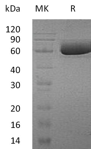 BL-0797NP: Greater than 95% as determined by reducing SDS-PAGE. (QC verified)Recombinant Human SMPDL3A Protein (C-6His)