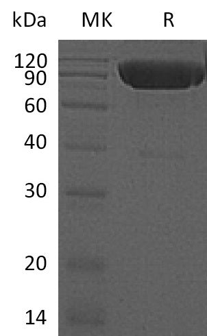 BL-0803NP: Greater than 95% as determined by reducing SDS-PAGE. (QC verified)Recombinant Mouse DR6 Protein (C-Fc-6His)