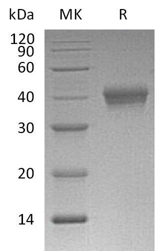 BL-1658NP: Greater than 95% as determined by reducing SDS-PAGE. (QC verified)Recombinant Mouse CD38 Protein (C-6His)